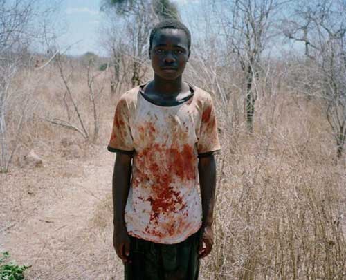 Quần[-]áo[-]người[-]hôi[-]thịt[-]dính[-]đầy[-]máu.